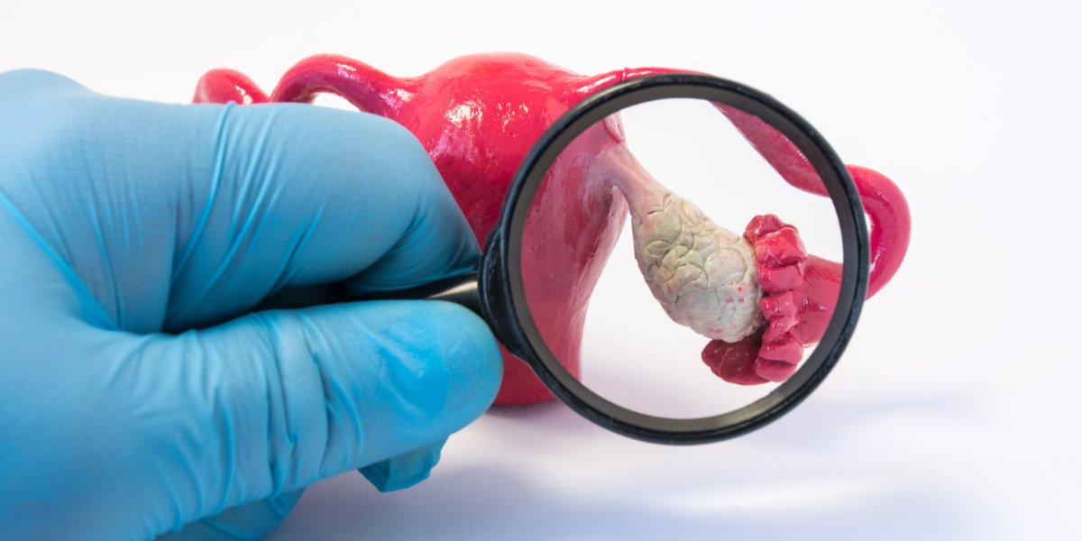 poor-ovarian-reserve