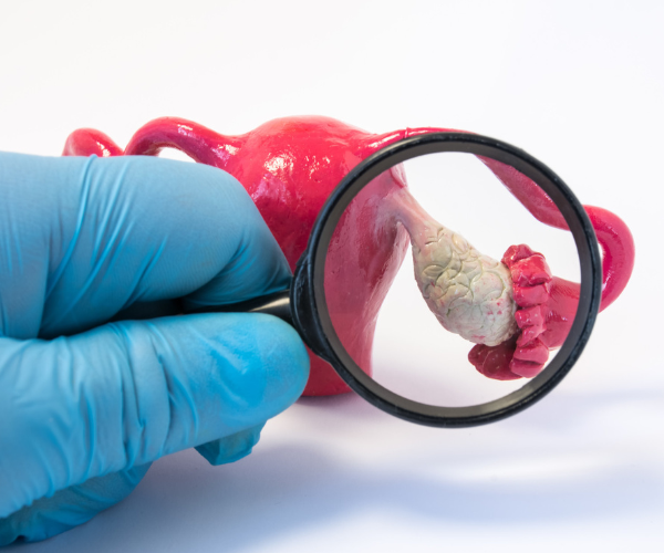 Poor Ovarian Reserve